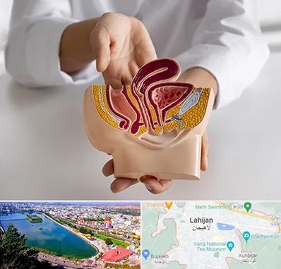 دکتر دستگاه تناسلی مردان در لاهیجان