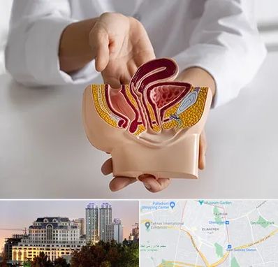 دکتر دستگاه تناسلی مردان در فرشته 