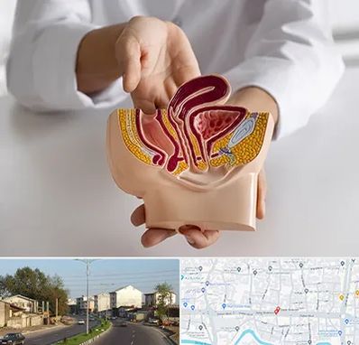 دکتر دستگاه تناسلی مردان در ضیابری رشت 