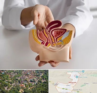دکتر دستگاه تناسلی مردان در دماوند