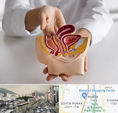 دکتر دستگاه تناسلی مردان در پونک 