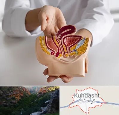 دکتر دستگاه تناسلی مردان در کوهدشت