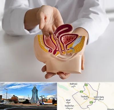 دکتر دستگاه تناسلی مردان در تایباد