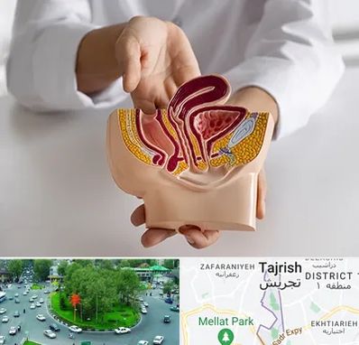 دکتر دستگاه تناسلی مردان در تجریش 