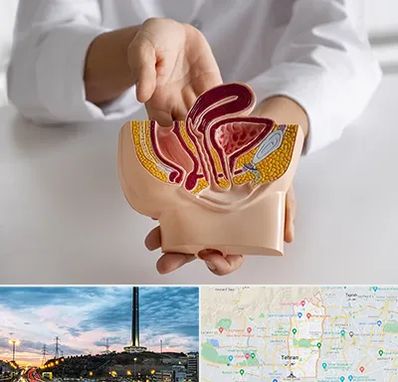 دکتر دستگاه تناسلی مردان در منطقه 2 تهران 