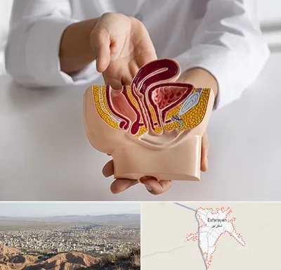 دکتر دستگاه تناسلی مردان در اسفراین