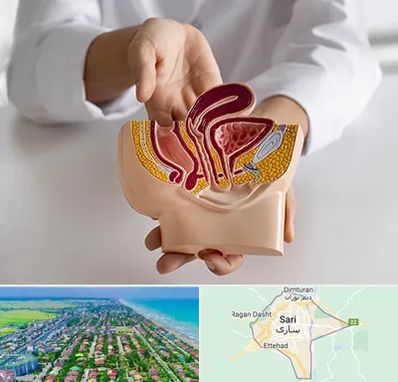 دکتر دستگاه تناسلی مردان در ساری