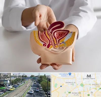 دکتر دستگاه تناسلی مردان در جنوب تهران 