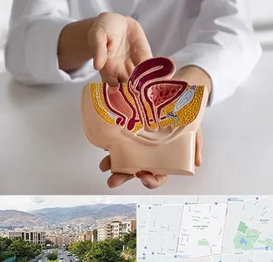 دکتر دستگاه تناسلی مردان در خانی آباد