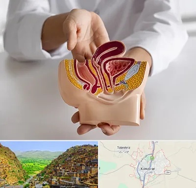 دکتر دستگاه تناسلی مردان در کامیاران