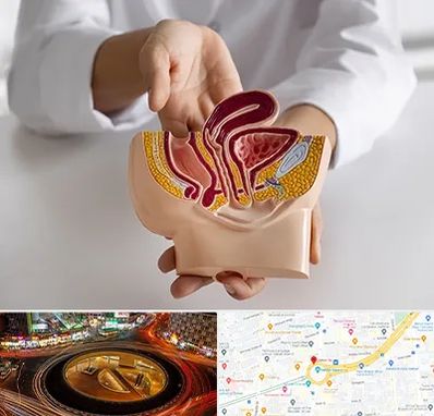 دکتر دستگاه تناسلی مردان در میدان ولیعصر 