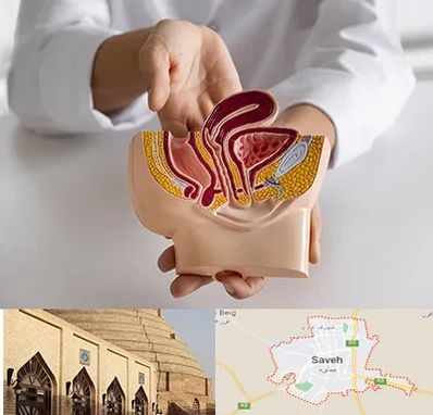 دکتر دستگاه تناسلی مردان در ساوه