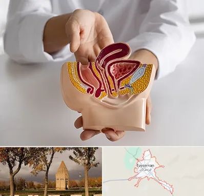 دکتر دستگاه تناسلی مردان در تویسرکان