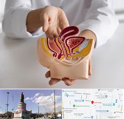 دکتر دستگاه تناسلی مردان در کارگر جنوبی 