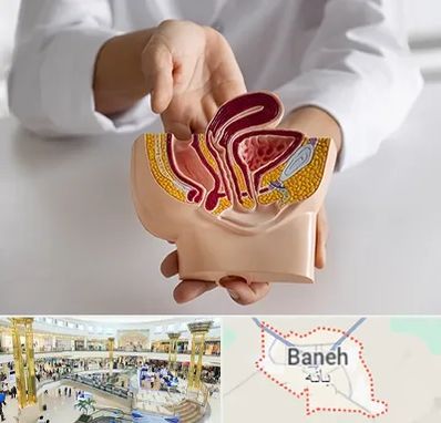 دکتر دستگاه تناسلی مردان در بانه