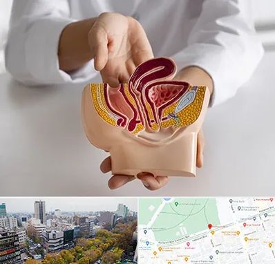 دکتر دستگاه تناسلی مردان در بلوار کشاورز