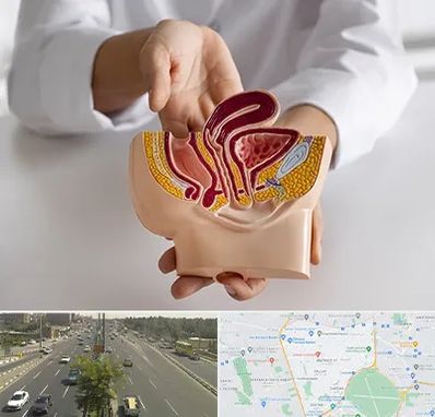 دکتر دستگاه تناسلی مردان در منطقه 17 تهران 