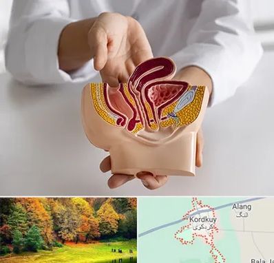 دکتر دستگاه تناسلی مردان در کردکوی