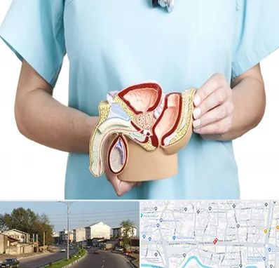 فوق تخصص دستگاه تناسلی مردان در ضیابری رشت 