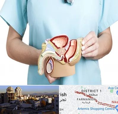 فوق تخصص دستگاه تناسلی مردان در فرمانیه 