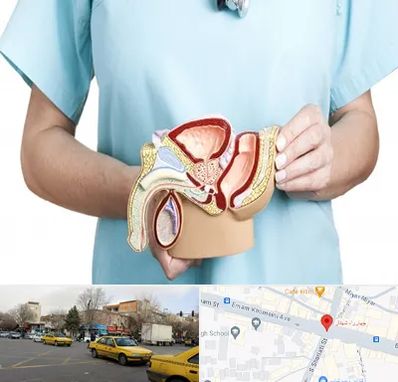 فوق تخصص دستگاه تناسلی مردان در شهناز تبریز