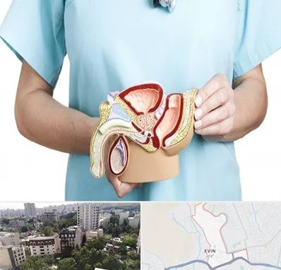 فوق تخصص دستگاه تناسلی مردان در اوین