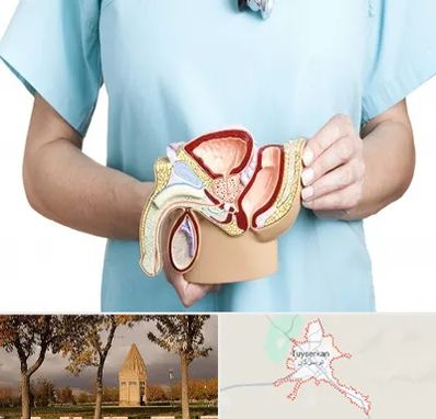 فوق تخصص دستگاه تناسلی مردان در تویسرکان