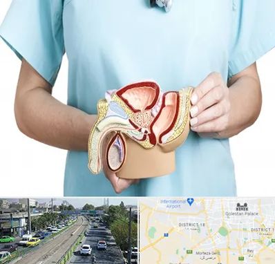 فوق تخصص دستگاه تناسلی مردان در جنوب تهران 