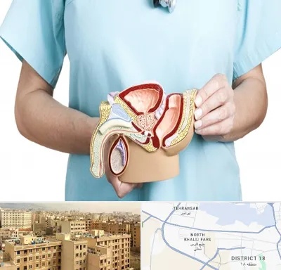 فوق تخصص دستگاه تناسلی مردان در جنوب غرب تهران