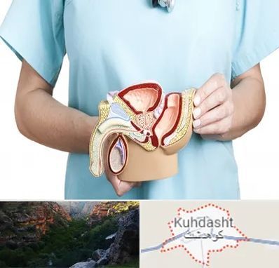 فوق تخصص دستگاه تناسلی مردان در کوهدشت
