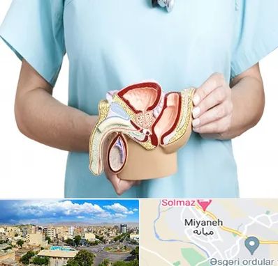 فوق تخصص دستگاه تناسلی مردان در میانه