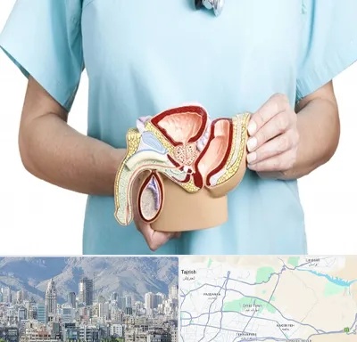 فوق تخصص دستگاه تناسلی مردان در شمال شرق تهران