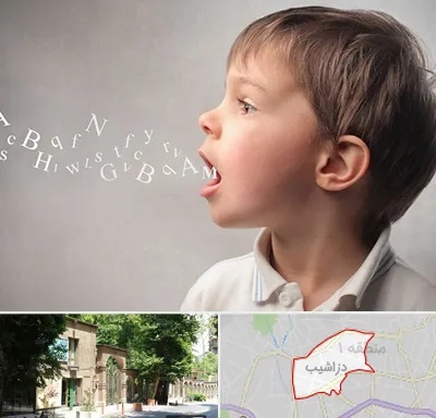 درمان لکنت زبان در دزاشیب