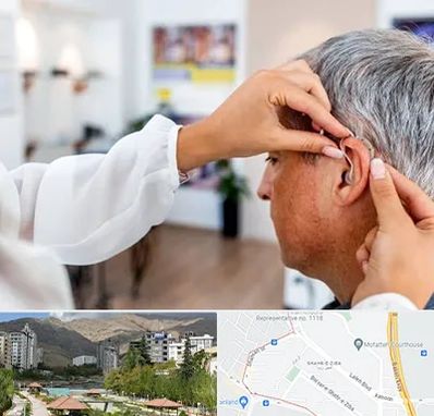 دکتر کم شنوایی در شهر زیبا 