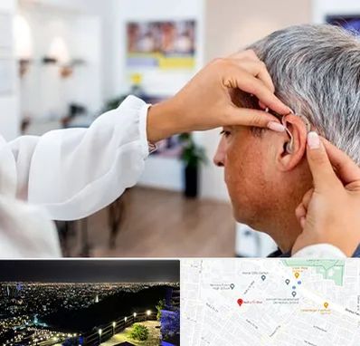 دکتر کم شنوایی در هفت تیر مشهد 