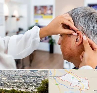دکتر کم شنوایی در یاسوج
