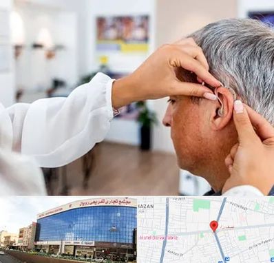 دکتر کم شنوایی در نصف راه تبریز