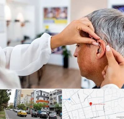 دکتر کم شنوایی در هفده شهریور تبریز