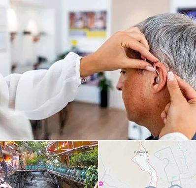 دکتر کم شنوایی در درکه