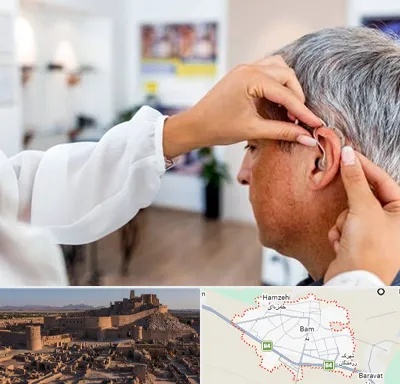 دکتر کم شنوایی در بم