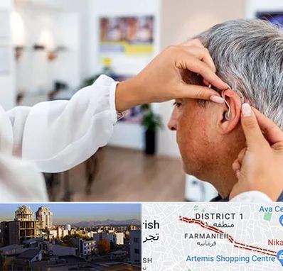 دکتر کم شنوایی در فرمانیه 