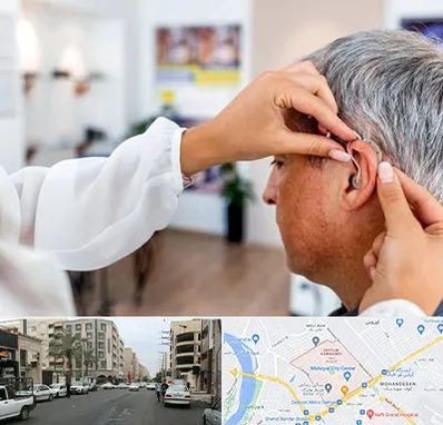 دکتر کم شنوایی در زیتون کارمندی اهواز 