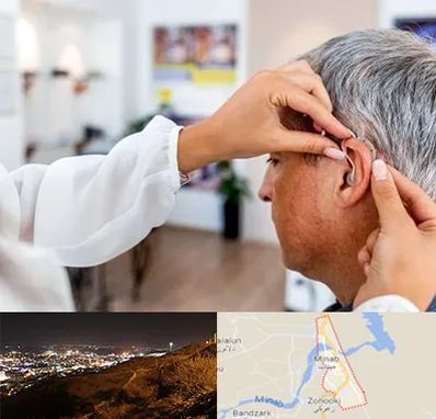 دکتر کم شنوایی در میناب