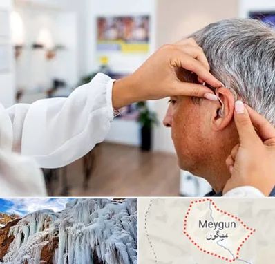 دکتر کم شنوایی در میگون