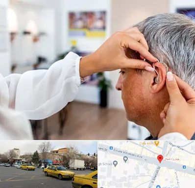 دکتر کم شنوایی در شهناز تبریز