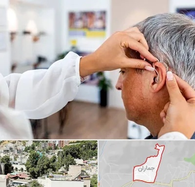 دکتر کم شنوایی در جماران