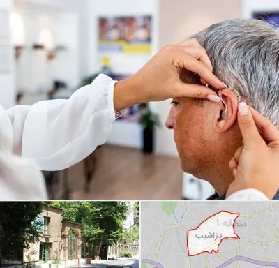 دکتر کم شنوایی در دزاشیب