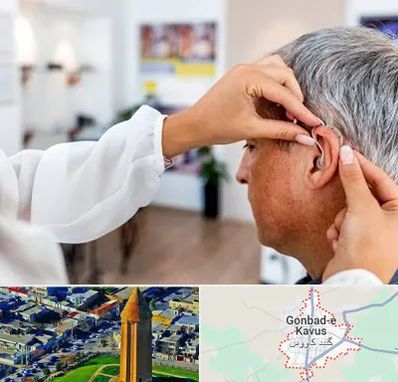 دکتر کم شنوایی در گنبد کاووس