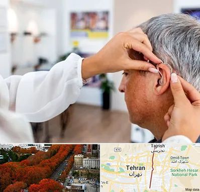 دکتر کم شنوایی در ولیعصر 