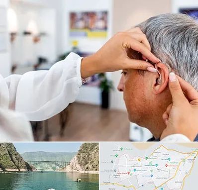 دکتر کم شنوایی در ایلام